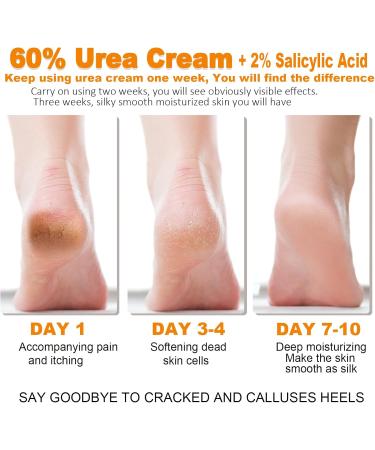 Cr me l'ur e 60 Percent pour les pieds ur e et miel - Buy Online on GoSupps.com