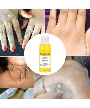 Caneem Thai Yellow Peeling Oil for Dark Spots on the Body Brightening Super Powerful Dark Skin with Hyaluronic Acid For - Buy Online on GoSupps.com