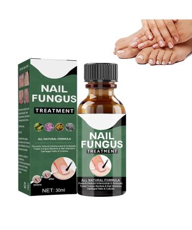 Fungal Nail Treatment Antifungal Nail Repair Antifungal Nail Treatment Toenail Care Solution Nail Treatment for Damaged Nails Renews Damaged Discolored Feet and Toenails
