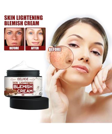 Whitening Spot Lightening Cream - Brighten & Exfoliate Skin Tone | Moisturizing Facial Repair Cream Type 3 - Buy Online on GoSupps.com