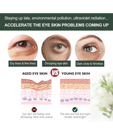 Jasmine ointment for dark circles under the eyes eye serum eye cream anti-aging eye serum removing dark circles under the eyes cream for minimizing dark circles under the eyes eye cream against - Buy Online on GoSupps.com