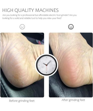 Exceart Electric Pedicure Set - Corneal Shavers & Foot Skin Remover Tools for Smooth Heels | International Shipping - Buy Online on GoSupps.com