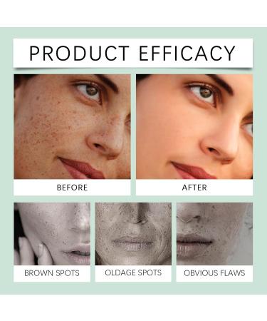  HNYXEQJL Set of 8 pigment spot correcting creams acne cream for women and men brightening balm for pores and pigment spots nourishing and soothing serum and - Buy Online on GoSupps.com