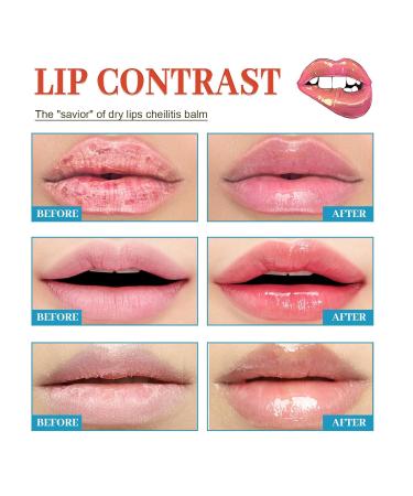 Healing Lip Balm for Dry Cracked Lips | Natural & Organic Cheilitis Treatment for Men Women & Children | Dermatologist Recommended All-Day Moisture - Buy Online on GoSupps.com