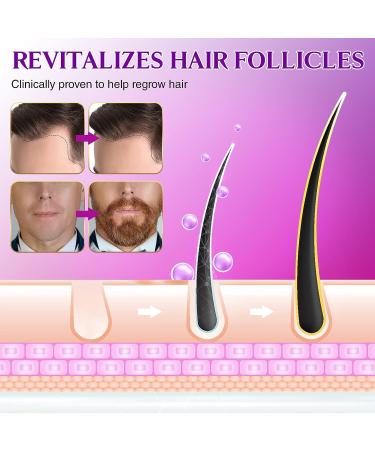 Minoxidil 5% Hair Growth Spray with Biotin - Promote Healthy Hair Regrowth - 2.0 fl.oz - Buy Online on GoSupps.com