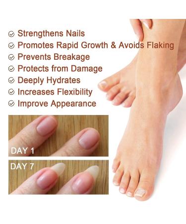 2Pcs Nail Repair Serum Set | 7 Days Growth & Strengthening Solution | Cuticle Oil Strengthener for Damaged Nails - Buy Online on GoSupps.com