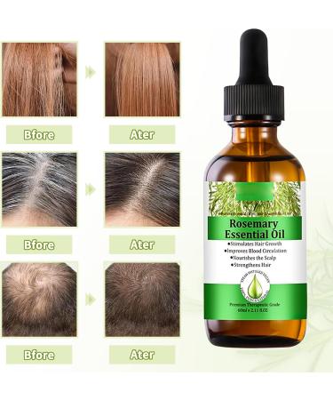 Rosemary Oil for Hair Growth Natural Organic Rosemary Essential Oil and Derma Roller Diluted for Eyelash Beard Eyebrows Face Skin Care Hair Loss Treatment Nourishes The Scalp Improve Blood Circulation - Buy Online on GoSupps.com