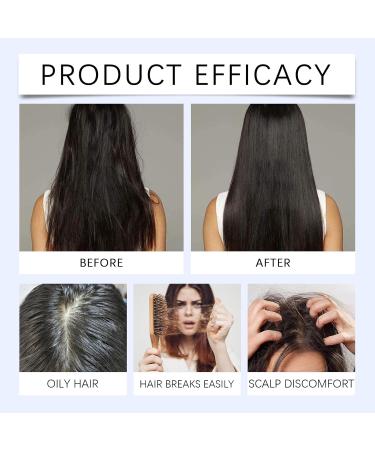 S rum capillaire roll-on la biotine pour la croissance des cheveux au romarin. Nourrit le cuir chevelu fortifie et paissit les cheveux. Soin quotidien pour femmes et hommes. Absorption (12PCS) - Buy Online on GoSupps.com