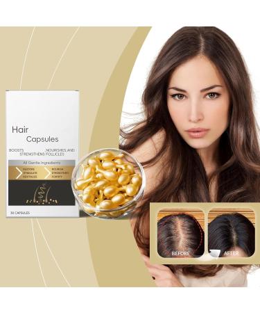  Generisch Hair Restoration Capsules - Pack of 30 Ginger Hair Growth Capsules - Anti-frizz - Regenerates and thickens hair by nourishing the scalp and hair follicles - Buy Online on GoSupps.com
