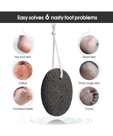 Pumice Stone for Feet - Natural Exfoliator and Callus Remover for Smooth Skin on Feet, Hands, Heels, and Elbows - Buy Online on GoSupps.com
