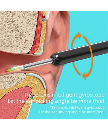 Ear Wax Removal Tool with 1296P Ear Camera & 6 Led Light for Earwax Removal - Black - Buy Online on GoSupps.com
