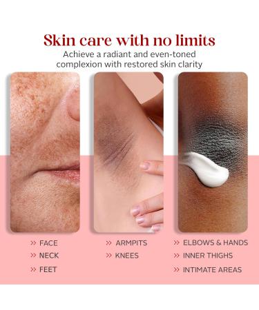 Dark Spot Corrector & Remover | Even Skin Tone for Face Neck & Body | Effective Treatment for Men & Women - Buy Online on GoSupps.com