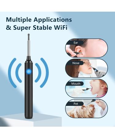 1296p Rechargeable Ear Wax Removal Tool Camera - Wireless Otoscope for Visual Ear Cleaning - Lighted Endoscope Clean Scope Kit - Buy Online on GoSupps.com