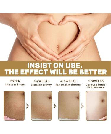 Emphasic Slimming Oil - 3 Pieces Skin Firming & Lifting Massage Oil for Women - 10 ml - Buy Online on GoSupps.com