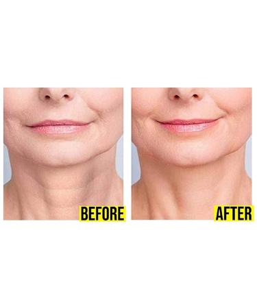 Hoosh Face Wrinkle Pads | 6 Pack Reusable Silicone Patches for Men & Women - Face Lift Mask for Neck, Forehead, Eyes, and Smile Lines Treatment - Buy Online on GoSupps.com