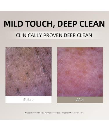 DEEOM Real Yam Brightening Cleanser Gentle Foaming Face Wash for Sensitive Skin with Rice Water Hydrating & Deep Pore Cleansing Korean Skincare 6.76 oz - Buy Online on GoSupps.com