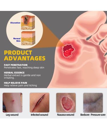 Bedsore Cream Pressure Sore Relief Cream Bed Sore Cream Fast Acting Fast Wound Healing Gel 20g - Buy Online on GoSupps.com