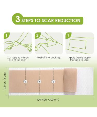 Buy AUSLKA Silicone Scar Sheets 1.6 x 120 Roll Professional Scar Tape for C-Section Tummy Tuck Keloid & Scar Treatments Fast International Shipping - Buy Online on GoSupps.com