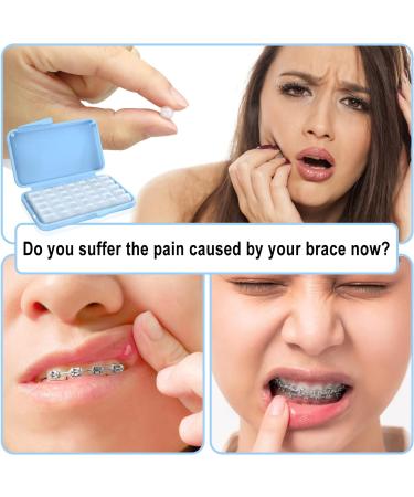 BVN Braces Wax - 20 Pieces Dental Wax Strips for Orthodontic Pain Relief | Colorful & Effective Tooth Wax for Irritation - Buy Online on GoSupps.com