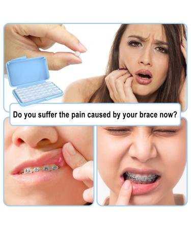 Orthodontic Braces Wax Strips - 10 Boxes | Dental Wax for Teeth Relief and Comfort - Buy Online on GoSupps.com