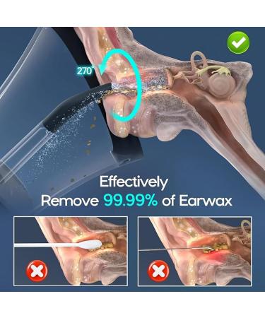 Buy Dotmalls Earclean Pro - Electric Ear Wax Removal Kit | Waterproof 4 Pressure Modes Effective Ear Cleaner for Adults - Buy Online on GoSupps.com