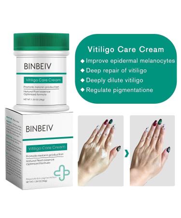 BINBEIV Vitiligo Care Cream - Pigmentation Regulating Formula | Fade Vitiligo & Boost Melanocytes - Buy Online on GoSupps.com