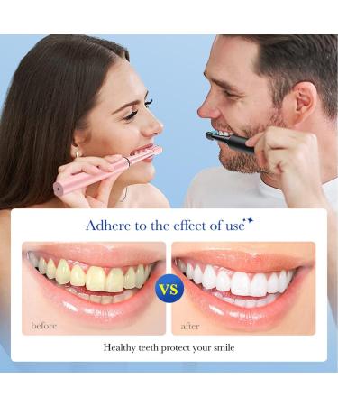 MagiForeign Whitening Toothpaste thorough cleaning of tea stains gentle and effective cleaning fresh breath gum care 120 g - Buy Online on GoSupps.com