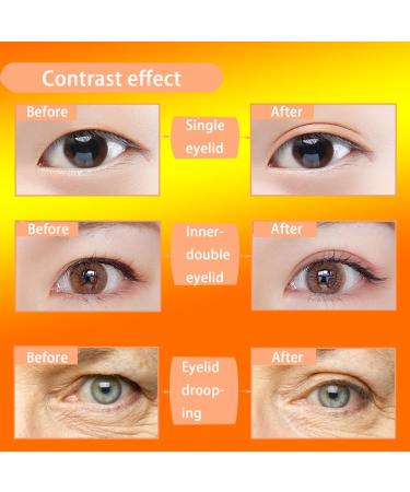 948Count Natural Invisible Single Side Eyelid Tape Stickers Medical-use Fiber Eyelid Correction Strip Instant Eye Lift Without Surgery Perfect for Droopy Hooded Uneven Mono-Eyelids HZ 948Count - Buy Online on GoSupps.com