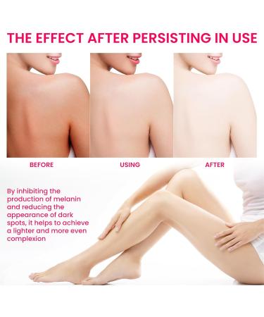 Uirpk Feminine Intimate Whitening Pinkish Essence - Brightening Formula for Armpits Back & Legs (2PCs) | Pure Intimate Care - Buy Online on GoSupps.com