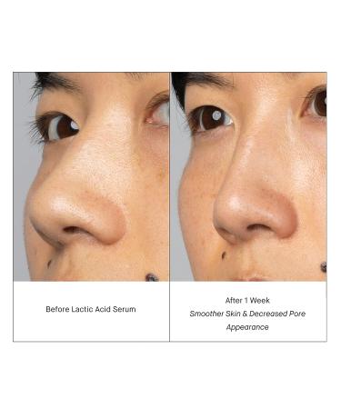 SHANI DARDEN Lactic Acid Face Serum Travel Size - Brightening PM Serum 0.34 fl oz - Buy Online on GoSupps.com