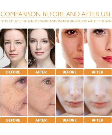 Kojic Acid Turmeric Oil Dark Spot Remover for Face Kojic Acid Face Moisturiser Glow Serum Kojic Acid Serum Dark Spot Corrector Turmeric Serum Reduce Fine Lines Melasma Acne Face Serum - Buy Online on GoSupps.com