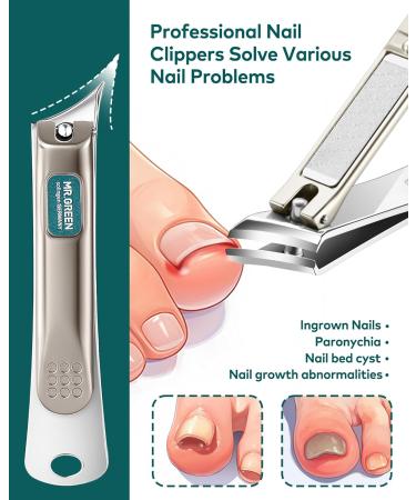 MR.GREEN Ingrown Nail Clippers Slanted Curved Blade Nail Clippers for Ingrown Nails Toenail Clippers for Thick Nails Medical Grade Stainless Steel Professional fingernail Clippers For Men And Women - Buy Online on GoSupps.com