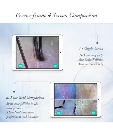 WDDEYYDS Scalp Detector & Hair Analyzer | 5x to 200x Zoom | LCD Display | Ideal for Hairdressing & Beauty Salons - Shop Now! - Buy Online on GoSupps.com