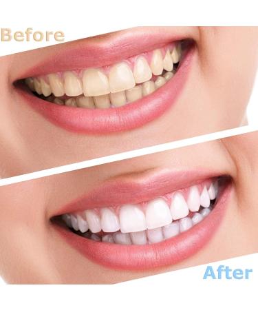Mxrfactory Dentures Pebble Gel Smile Veneer - Comfort Fit Flex Veneers for Perfect Smile - 12 Pairs for Men & Women - Buy Online on GoSupps.com