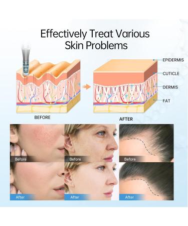 Dr.pen M8 Microneedling Pen Wireless Professional Micro Needling Pen Skin Care Tool Kit for Face and Body Auto Microneedling Device Set for Face 6 Speeds with 10 Nano Round Cartridges (UK Plug) - Buy Online on GoSupps.com