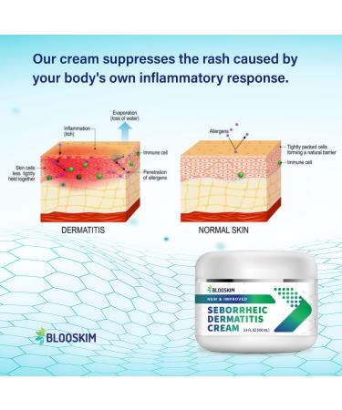 Seborrheic Dermatitis Cream - Fast-Acting Treatment for Face, Scalp, Folliculitis, Dandruff, Psoriasis - 3.4 oz - Buy Online on GoSupps.com