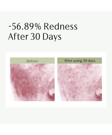 Centella Asiatica Repairing Face Serum | GUYU Dual Truffle Hydro-Oil Facial Serum | Hyaluronic Acid Vitamin E Panthenol Squalane Oil Beta-Glucan | for Soothing Reducing Redness (1.18 Fl Oz/35ml) - Buy Online on GoSupps.com