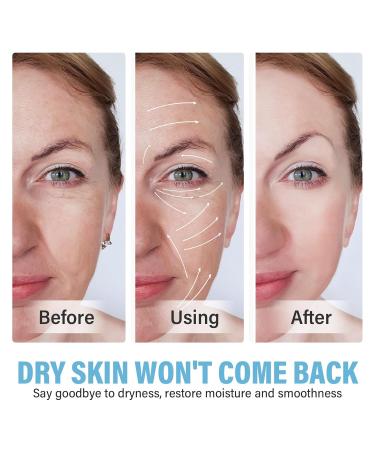 Azel ic Acid Serum Natural Azelaic Acid for Face Facial Redness Soothing Formula Helps Calm & Brighten Skin - Buy Online on GoSupps.com