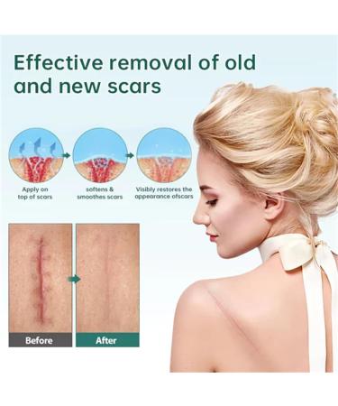 Goopgen Advanced Scar Removal Serum - Effective Scar Repair Spray (2pcs) - Buy Online on GoSupps.com