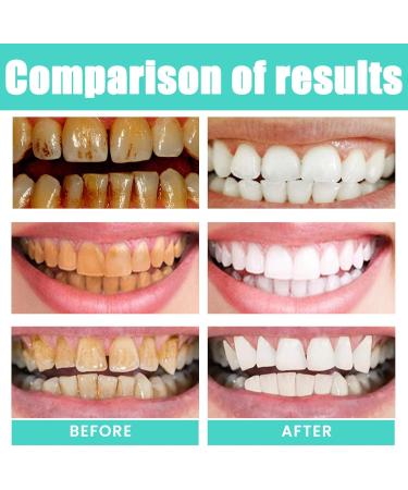 Coconut mouthwash Mouthwash with oil 100 ml mouthwash with mint and coconut contains a tongue scraper and longlasting mouthwash Ora mouthwash - Buy Online on GoSupps.com