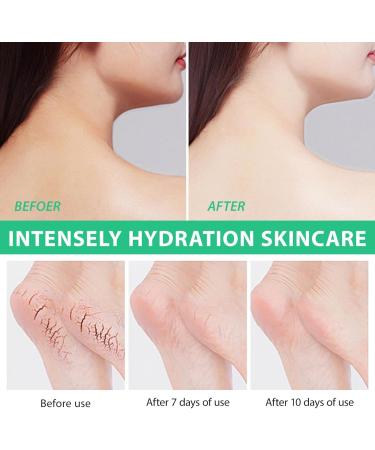 40% Urea Foot Cream - Ultra Moisturizing Urea Foot Cream Plus Deeply Hydrating - 2% Salicylic Acid Urea Cream - Foot Cream for Cracked Heels and Dry Skin - Nourish Foot Moisturiser 150g - Buy Online on GoSupps.com