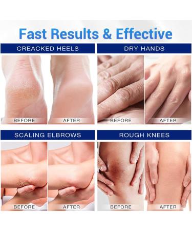 EHIOG Urea Cream 40 for feet hands heels and elbows foot cream with salicylic acid and hyaluronic acid intensive hydration for dry skin 150 g - Buy Online on GoSupps.com