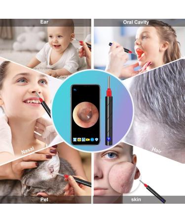 Urbesty Ear Wax Removal Kit with 1080P HD Camera - Wireless Otoscope Waterproof Compatible with Smartphones & Tablets - Effective Earwax Cleaner - Buy Online on GoSupps.com