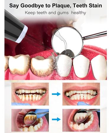 Ultrasound Tooth Cleaning Set - Tartar Remover for Home Care | 5 Modes & 3 Interchangeable Heads - Black - Buy Online on GoSupps.com