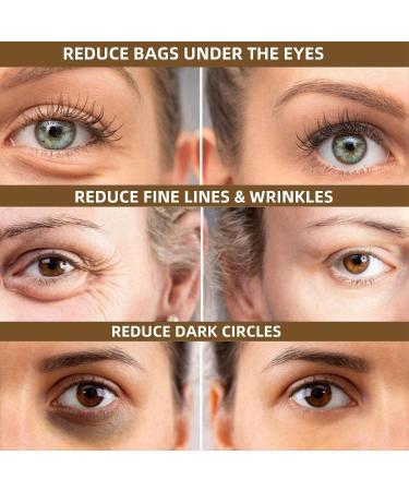 Retinol Eye Cream Anti Aging Eye Cream with Retinol Serum Aha 30% & Bha 2% Under Eye Cream for Women/Men Skincare Eye Cream for Dark Circles Puffy Eyes Reduce Fine Lines Brightening Eye Repair Cream - Buy Online on GoSupps.com