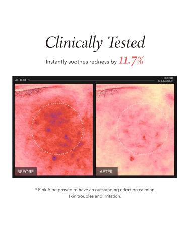 APRILSKIN Pink Aloe Facial Polish Cleanser - Gentle Exfoliating Mungbean & Soybean Scrub Removes Waterproof Makeup Non-Comedogenic Korean Skincare for All Skin Types - Buy Online on GoSupps.com