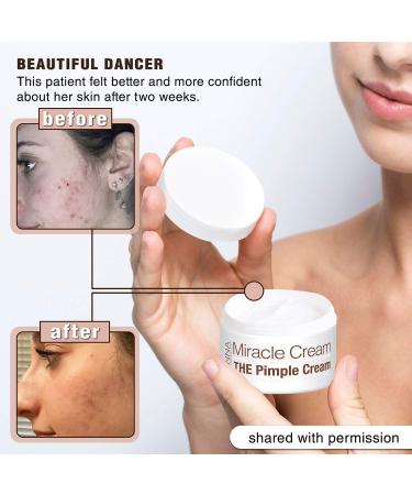 Anna Guanche MD Miracle Cream - Fast-acting Acne Treatment for Pimples & Redness - Buy Online on GoSupps.com