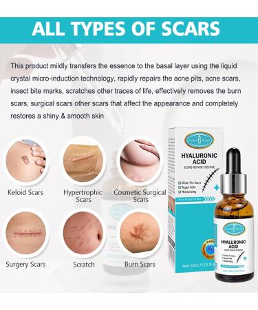 AICHUN BEAUTY Hyaluronic Acid Serum for Scars - Moisturizing Repair Essence for Skin Nourishment & Hydration - 30ml - Buy Online on GoSupps.com