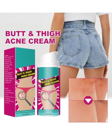  Mikabila (10 F)100ml Ass Acne Cream Glutei Pimple Reduction Glutei Pimple Cream Butt Pimple Clearing Removes Pimple and Redness for Glutei and Coscebutt Cream - Buy Online on GoSupps.com
