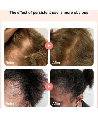 Oil for Follicle Care Strengthening Moisturizing Nourishing 40ml Safe Ingredients Suitable for All Hair Types - Buy Online on GoSupps.com